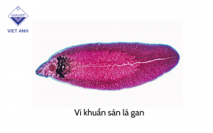 Benh san la gan 2