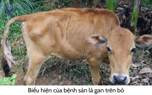 Benh san la gan 4