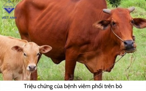 Benh viem phoi 3
