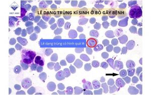 San pham AZ Gluco KC Bamin giup tang suc de khang cho bo 1