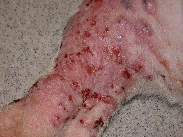 Triệu chứng của ghẻ Sarcoptic